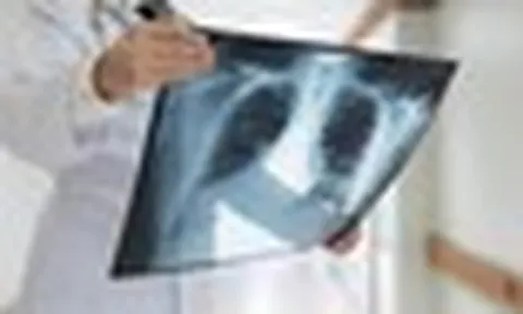 Chụp chiếu khắp nơi không ra bệnh, nam thanh niên 27 tuổi nhập viện tâm thần vì lý do bất ngờ