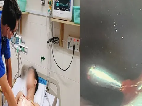 Diễn viên xiếc ở Cần Thơ nôn ra 1/2 lít máu sau khi biểu diễn