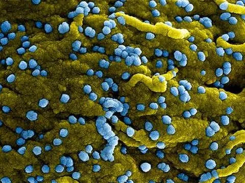 WHO tuyên bố đợt bùng phát loại virus mới