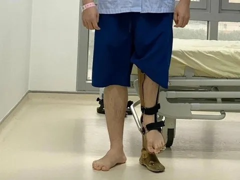 Kéo dài chân thành công thêm 18 cm cho chàng trai 23 tuổi