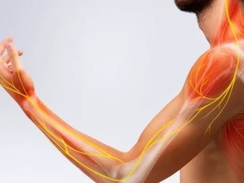 Bệnh viêm đa dây thần kinh nguy hiểm mức nào?