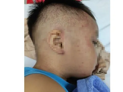 Cấp cứu kịp thời bé trai 4 tuổi bị bạo hành nhét vào tủ đông