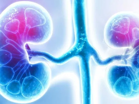 Thói quen xấu khiến nhiều người mắc ung thư thận lúc nào không hay