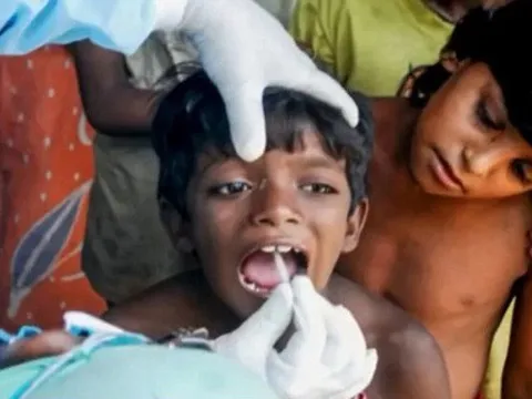 Phát hiện căn bệnh lạ lây lan nhanh ở trẻ em Ấn Độ