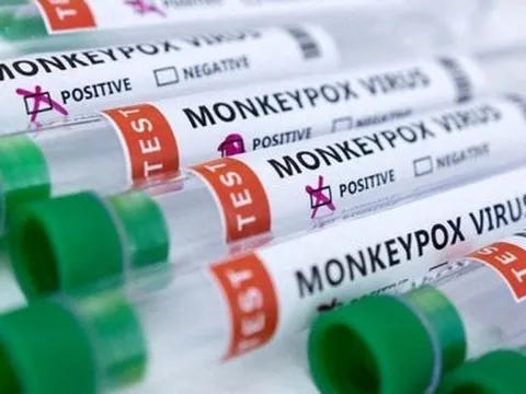 Cuba xác nhận trường hợp mắc đậu mùa khỉ đầu tiên đã tử vong