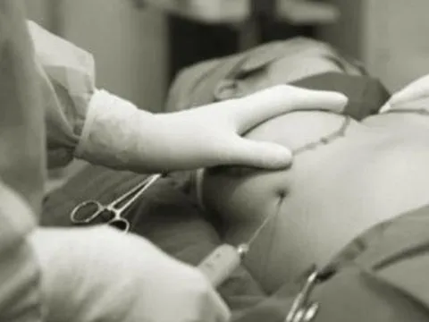 Thu gọn ngực ở spa cô gái 22 tuổi nhập viện khẩn cấp