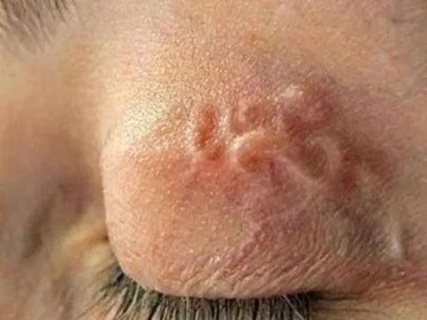 Sốc: Cô gái 29 tuổi nhưng chỉ nặng 32kg vì mắc bệnh này