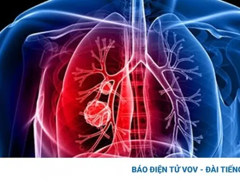 Triệu chứng của bệnh ung thư phổi mà bạn không hề ngờ tới