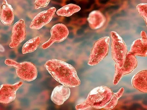 Cảnh báo siêu vi khuẩn nhiều người mắc nhưng ít người biết, có thể gây vô sinh