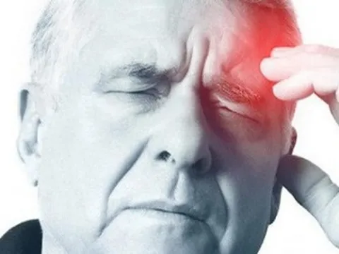 Làm thế nào để bảo vệ bản thân khỏi đột quỵ?