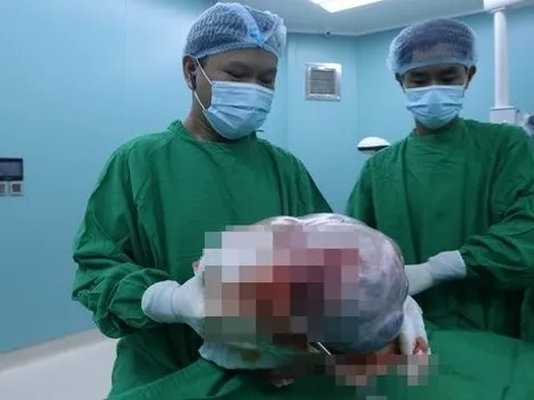 Phẫu thuật cắt khối u buồng trứng nặng 11,5kg cho bệnh nhân 55 tuổi