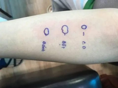 Cô gái trẻ ngất xỉu, nổi phát ban sau khi ăn bánh mì lót dạ