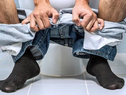 Đại tiện ra máu, đi khám mới phát hiện polyp "khổng lồ"