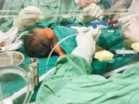 Thay máu toàn phần cứu bé trai 3 ngày tuổi bị vàng da nguy kịch