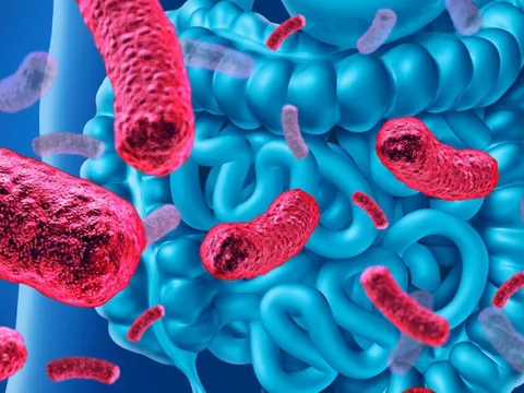 Phát hiện giật mình về thứ kết nối cơn đau bụng và ung thư ruột