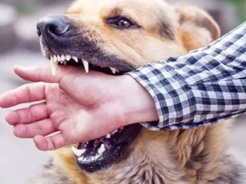 Cách xử trí khi bị chó, mèo cào, cắn