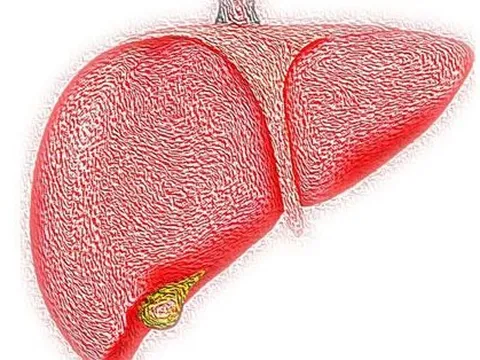 Phát hiện quan trọng về căn bệnh được ví như "kẻ giết người thầm lặng"