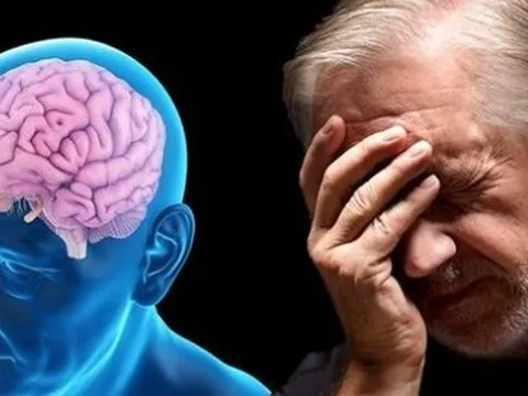 Thói quen không ngờ dẫn đến bệnh Alzheimer