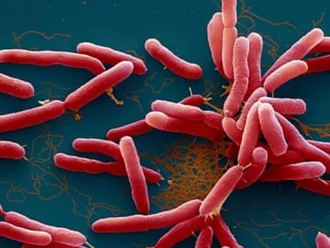 Phát hiện 3 ca mắc Whitmore tại Thanh Hóa, Đắk Lắk, Bộ Y tế ra công văn khẩn