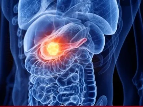 50% số ca ung thư tử vong vì phát hiện 'quá muộn': 10 dấu hiệu không nên bỏ qua