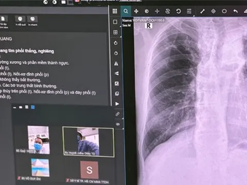 Trạm y tế đầu tiên trên cả nước ứng dụng trí tuệ nhân tạo