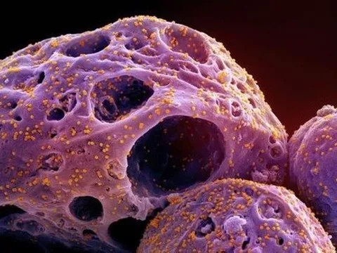 Phát hiện xu hướng lẩn tránh kháng thể ngày càng tăng của các biến thể phụ Omicron mới