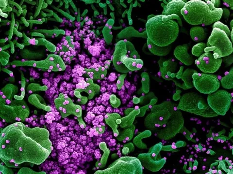 Phát hiện biến chủng COVID-19 mới BW.1 mang 54 đột biến, lan nhanh ở Mexico