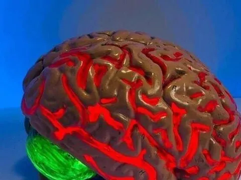 Phương pháp mới điều trị ung thư não hiệu quả