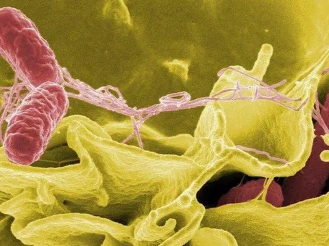 Lưu ý khi điều trị bệnh nhiễm khuẩn Salmonella