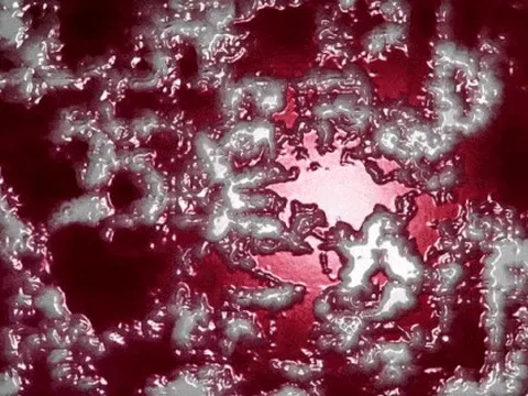 Tìm thấy dạng kháng kháng sinh mới cực kỳ khó phát hiện