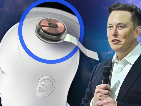 Elon Musk: ‘Công ty của tôi tự tin cấy chip vào não người trong 6 tháng tới’