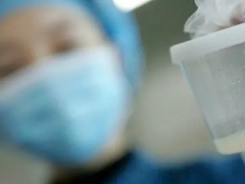 Lý giải nguyên nhân chất lượng tinh trùng nam giới ngày càng giảm