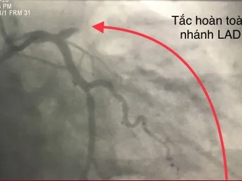 Trời lạnh tác động đến bệnh tim thế nào?