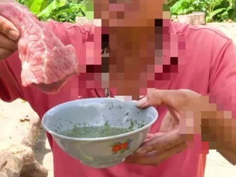 Ăn đồ sống coi chừng ký sinh trùng