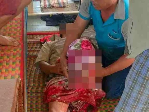 Cà Mau: Cứu giúp ngư dân bị tai nạn trên biển