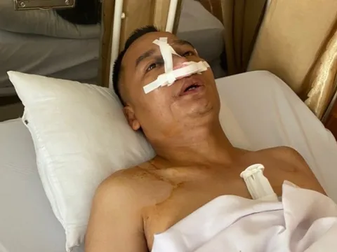 Hỗn chiến như phim trước quán The Sun: Không "chìm"!