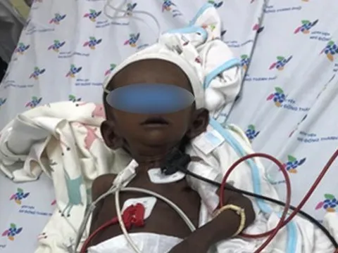 Bị bệnh hiếm gặp, bé gái người Việt da vàng chuyển sang... màu đen