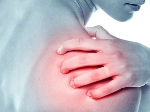 Cảnh báo: Dấu hiệu bệnh ung thư phổi thường thấy ở vai và cánh tay