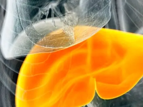 Trời lạnh là thời điểm bùng phát bệnh gan cao: 4 lý do bạn cần biết để tránh