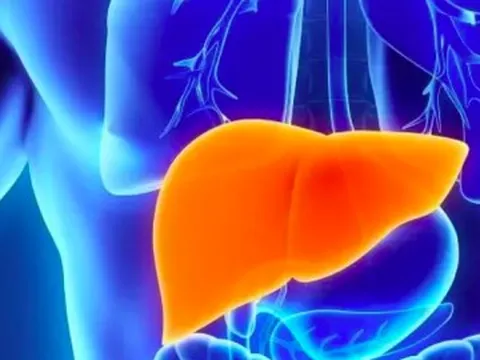 4 triệu chứng cảnh báo mức độc tố trong gan quá cao: Nên sớm thải độc bảo vệ gan