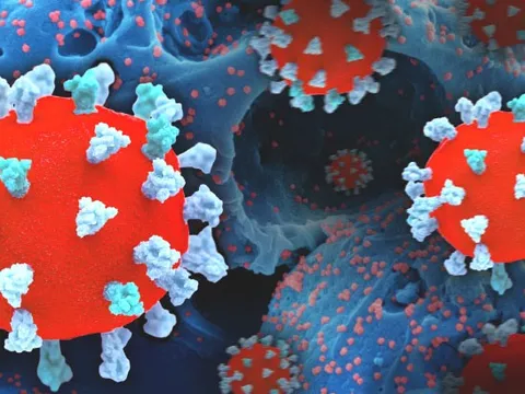 Phát hiện mối liên hệ bất thường giữa COVID-19 và gan nhiễm mỡ