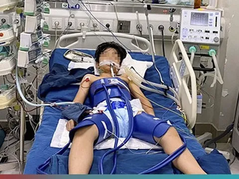 Bé trai ngừng tim sau pha bắt bóng