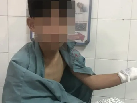 Tai nạn nghiêm trọng do pháo nổ