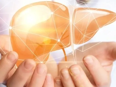 Dấu hiệu cho thấy bạn đang bị gan nhiễm mỡ