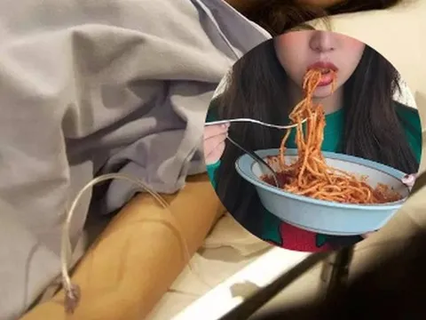 Cô gái bị loét ruột, xuất huyết tiêu hóa vì món ăn nhanh từng khiến người trẻ “phát cuồng”
