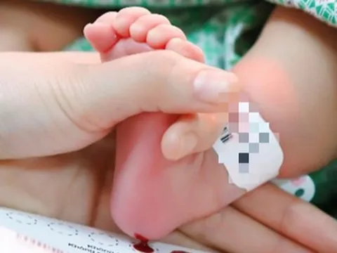 Mẹ trên 35 tuổi, bố trên 45 tuổi có nguy cơ sinh con bị khuyết tật