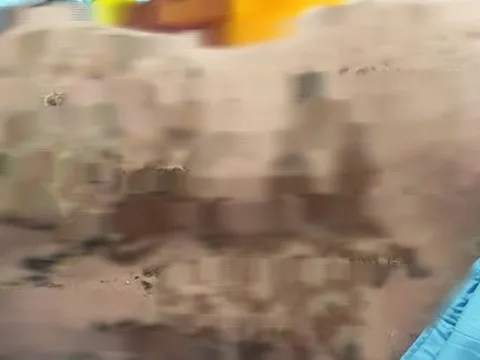 Suýt mất mạng vì dùng thuốc nam không rõ nguồn gốc chữa đau khớp