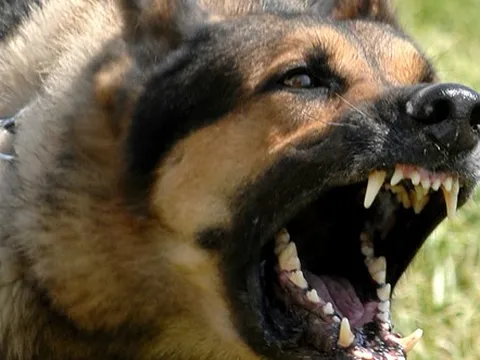 Sang nhà hàng xóm chơi, bé 3 tuổi bị chó cắn rách mặt