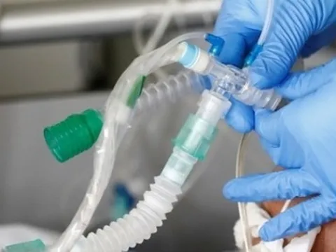 Người đàn ông mở mắt và còn thở sau 5 tiếng nằm trong nhà xác