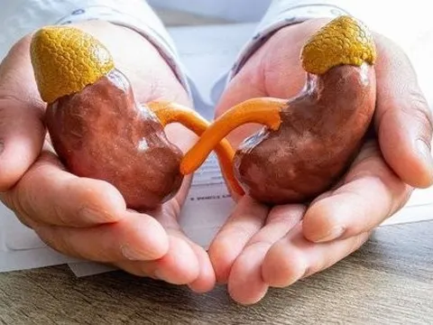 4 gạch đầu dòng ai cũng nên biết để có 2 quả thận khoẻ mạnh